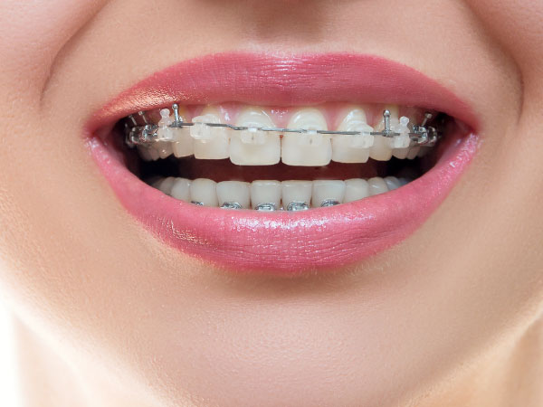 Ortodoncia-clinica-dental-jorge-mato-verin-salamanca-la-alberca-interior